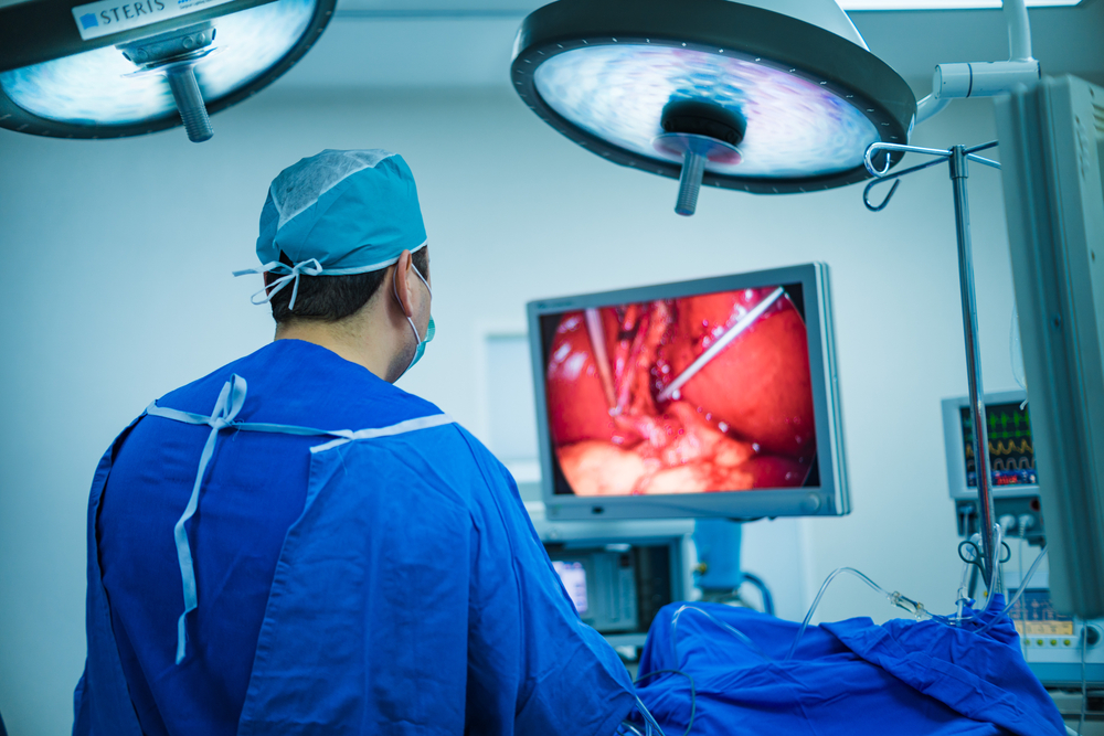 Surgeon looking at a surgical screen in an operating room.
